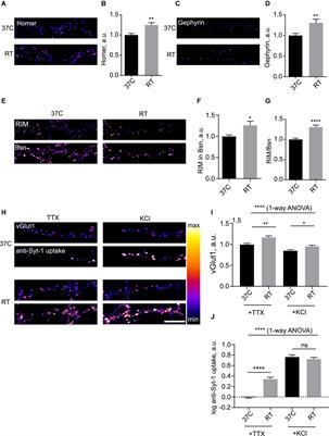 Temperature-dependent structural plasticity of hippocampal synapses